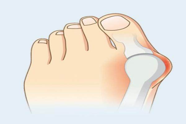 圣嘉新蘇敬達(dá)和望京醫(yī)院陳思哪個(gè)好?蘇敬達(dá)微孔祛大腳骨優(yōu)勢明顯！ 