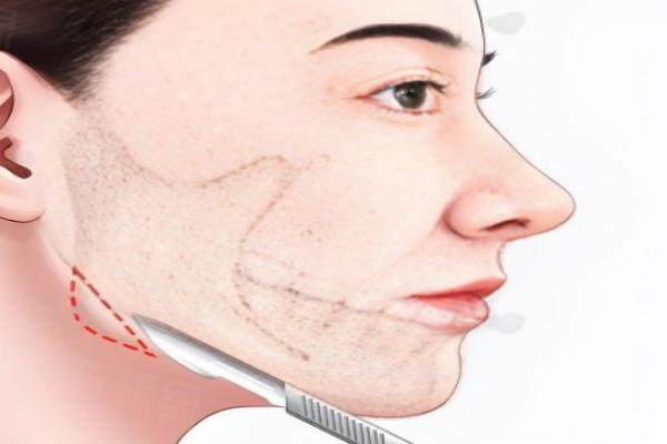 張笑天有磨骨資格嗎？20多年輪廓整形經(jīng)驗(yàn)，多項(xiàng)專利認(rèn)證，磨骨資格妥妥的！ 