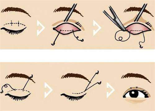 杭州藝星醫(yī)療美容醫(yī)院怎么預約掛號？官網(wǎng)或電話預約，方便快捷超省心！ 