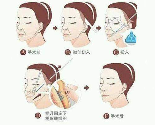 嘉興藝星整形醫(yī)院好嗎？先進(jìn)設(shè)備+專業(yè)醫(yī)生，多項(xiàng)目效果顯著滿意度高！ 