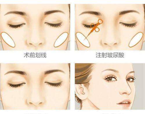 二、藝星醫(yī)療美容醫(yī)院醫(yī)生的技術(shù)怎么樣？m.sanboo.cn/