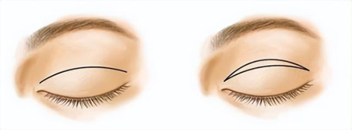 杭州藝星醫(yī)療美容醫(yī)院余杭分院怎么樣？多項(xiàng)特色醫(yī)美項(xiàng)目+權(quán)威專(zhuān)家團(tuán)隊(duì)超靠譜！ 