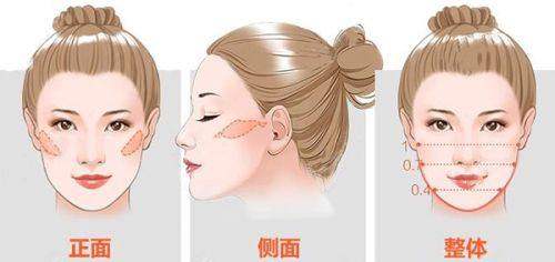 西安藝星整形美容技術(shù)怎么樣？多維美雕隆鼻與眼部手術(shù)超贊，技術(shù)靠譜！ 