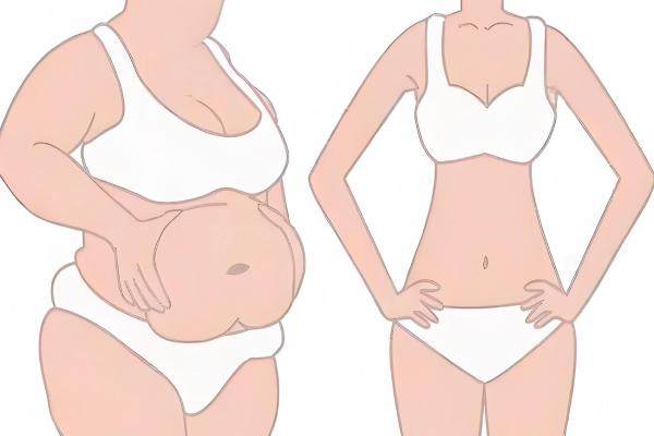 北京王光輝整形醫(yī)生擅長(zhǎng)項(xiàng)目有哪些？擅長(zhǎng)眼部、鼻部、自體脂肪填充等，附雙眼皮口碑及案例參考