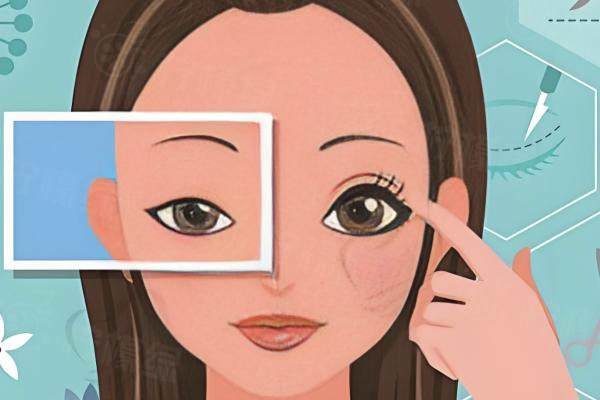 杭州天鑫醫(yī)療美容做雙眼皮怎么樣？獨(dú)創(chuàng)技術(shù)+超微創(chuàng)縫合，效果自然恢復(fù)快！ 