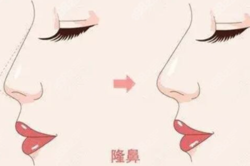 湖北十堰安琪儿医学美容门诊部医生介绍？副主任医师领衔眼鼻精雕与抗衰定制方案