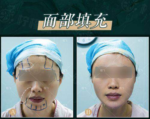 湖北十堰安琪儿医学美容门诊部正规吗？持证合规医生经验丰富价格透明口碑好