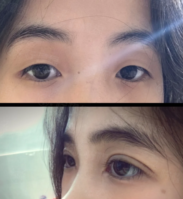 深圳龙华罗文医疗美容吸脂怎么样？正规机构医生技术好分层塑形恢复快线条自然