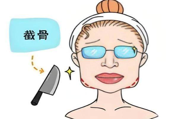 上海时光何晋龙手术贵吗？磨骨 3.8 万起/轮廓固定技术自然