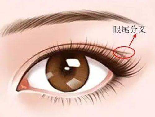 深圳广尔美丽医院隆鼻怎么样？王天国院长桃花鼻技术自然立体，十年口碑见证东方美学