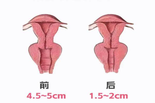 3D生物束带紧缩术能维持多久？权威解析：效果自然持久，技术优势显著提升满意度