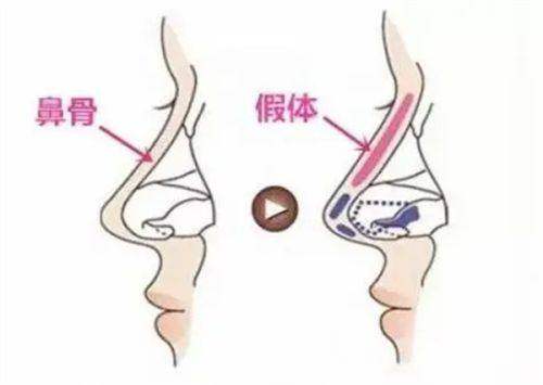 上海华美在上海很出名吗？是三级整形医院，二十年老牌机构医生技术强口碑好