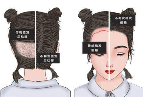 北京漾格医疗美容医院怎么样？公立背景医生亲诊微创自然