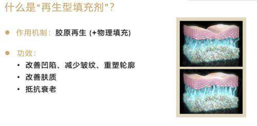 熊猛胸部高难度修复预约面诊？成都美莱连锁资质强，专家定制方案重塑自然胸型获肯定
