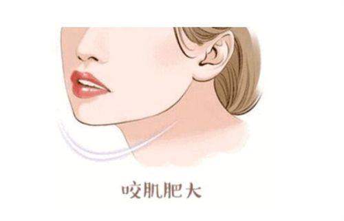 韩国healing眼科怎么预约｜首尔Eonni小程序预约攻略通过中文界面一键锁定首尔精细化眼整形时段