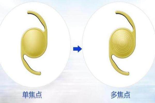 双焦点人工晶体 www.okostu.com