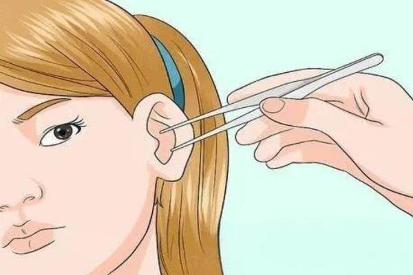 面部异物取出手术.jpg