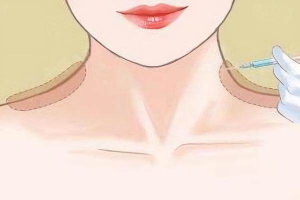 肩頸整形www.sanboo.cn