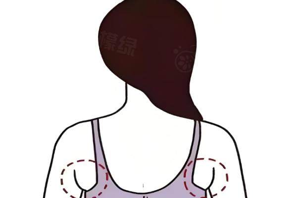 背部吸脂术的特点有哪些.jpg