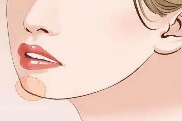 硅膠墊下巴www.sanboo.cn