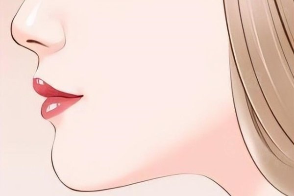 下巴假體取出www.sanboo.cn