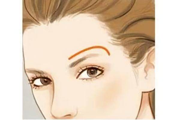 玻尿酸豐眉弓www.sanboo.cn