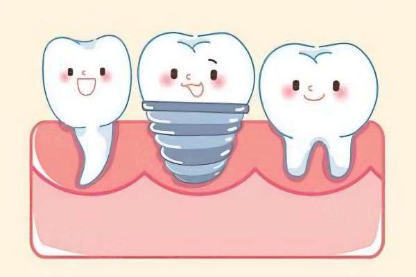 牙齒種植www.sanboo.cn