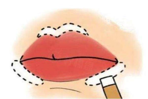 什么是口唇整形手術(shù)http://www.sanboo.cn/