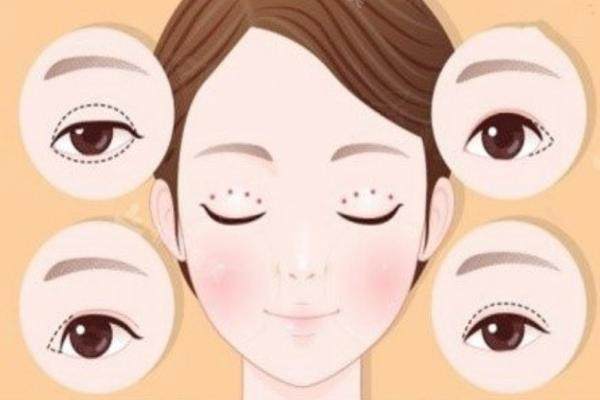 雙眼皮 http://www.sanboo.cn.jpg