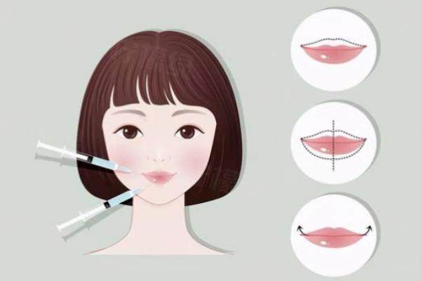 口唇整形的危害有哪些http://www.sanboo.cn/