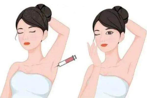 注射去狐臭能維持多久http://www.sanboo.cn/