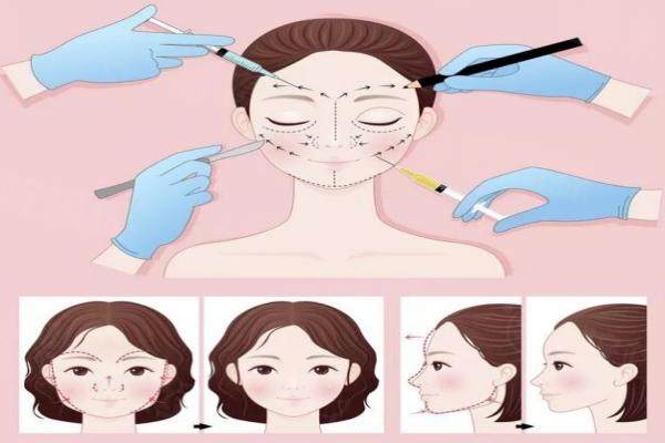 顴骨顴弓www.sanboo.cn