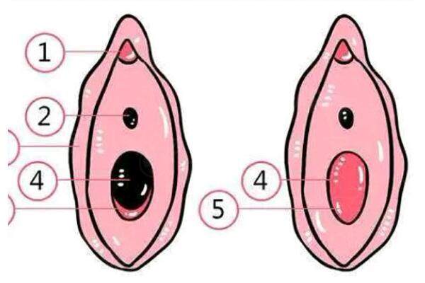 處女膜修復(fù)手術(shù)