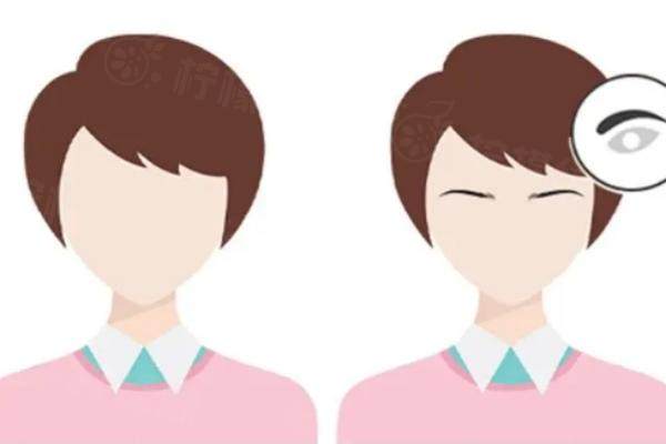 眉毛種植后能維持幾年www.sanboo.cn