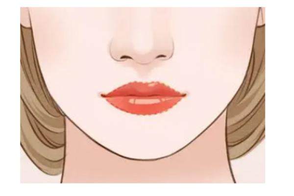 玻尿酸豐唇多少錢