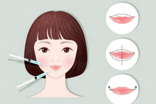 豐唇是怎么做的