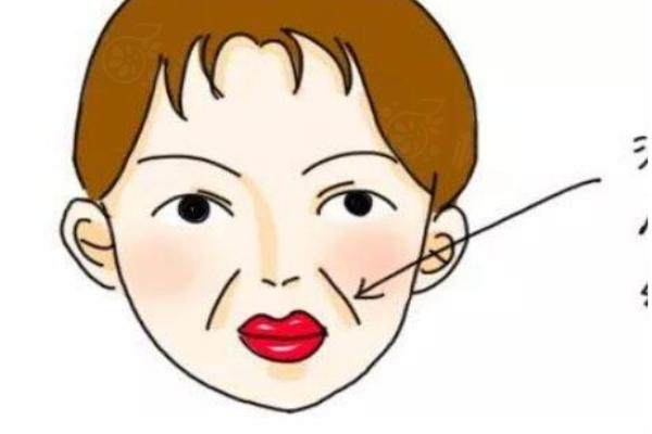 玻尿酸祛法令紋能保持多久http://www.sanboo.cn/