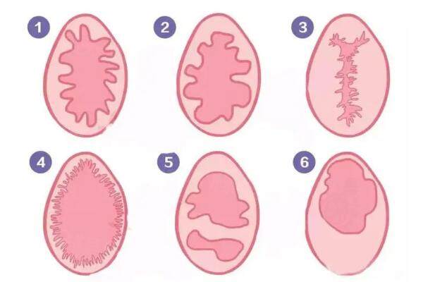 做了處修手術(shù)后能發(fā)現(xiàn)嗎