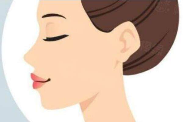 那鷹鉤鼻的特征有哪些