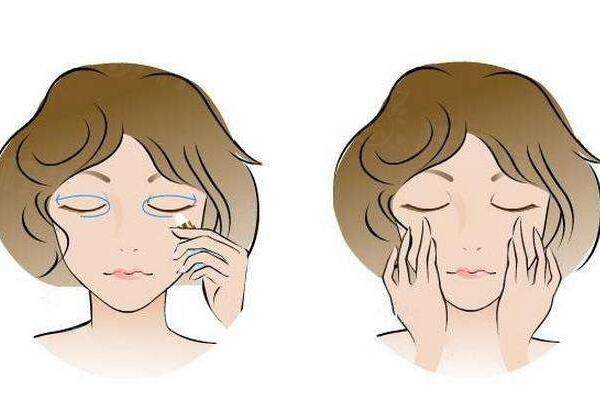 外切去眼袋手術(shù)的手術(shù)方法