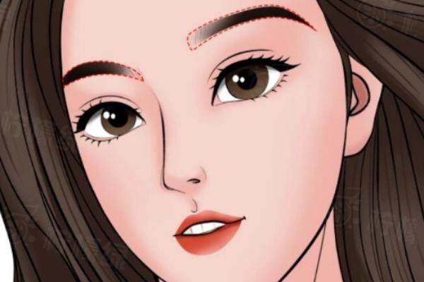 什么是眉毛種植手術(shù)http://www.sanboo.cn/