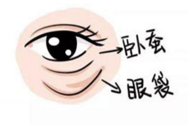 玻尿酸填充臥蠶幾天消腫www.sanboo.cn