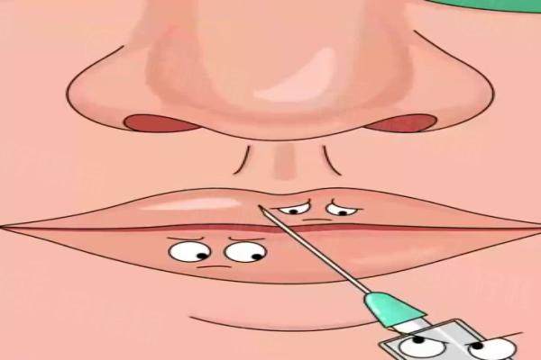 玻尿酸豐唇多少錢www.sanboo.cn