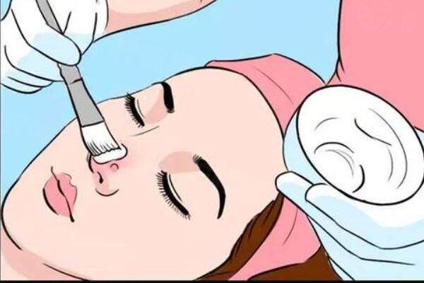 化學換 膚術攻略