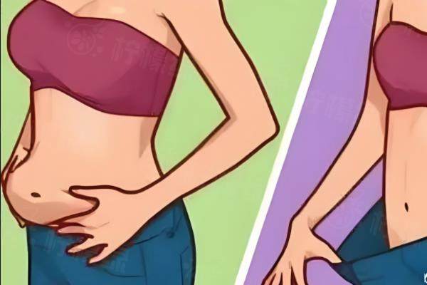 哪種吸脂方法比較好？www.sanboo.cn