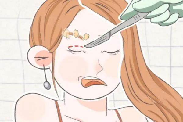 昆明華美美萊誰做眼睛做得好？www.sanboo.cn