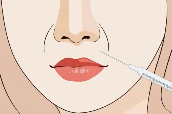 法令紋用什么玻尿酸比較好www.sanboo.cn