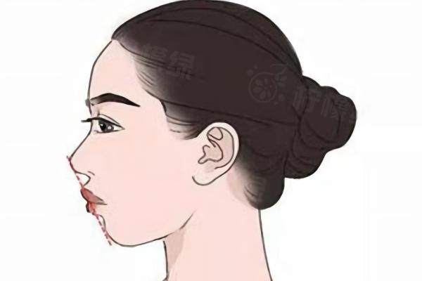 吳中興正頜手術技術怎么樣www.sanboo.cn