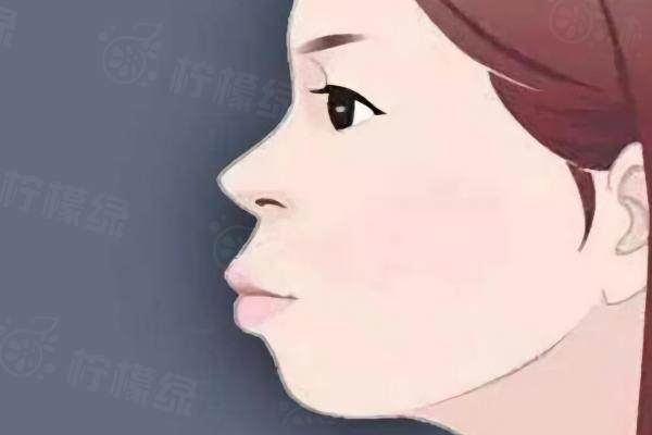 吳中興正頜手術技術怎么樣www.sanboo.cn