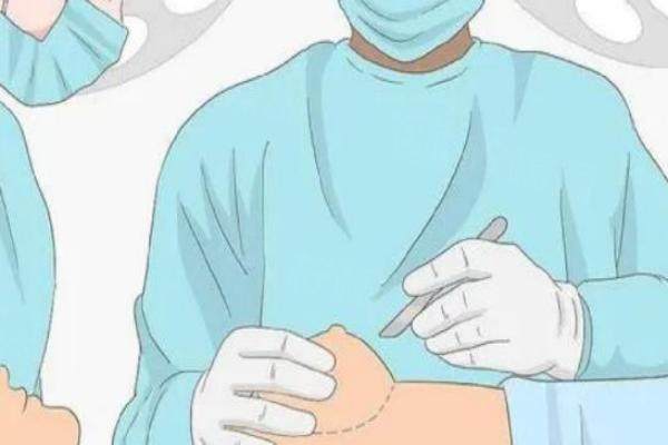 南京朱淼醫(yī)生縮胸怎么樣？微創(chuàng)技術(shù)出色，口碑也不錯(cuò)！okostu.com